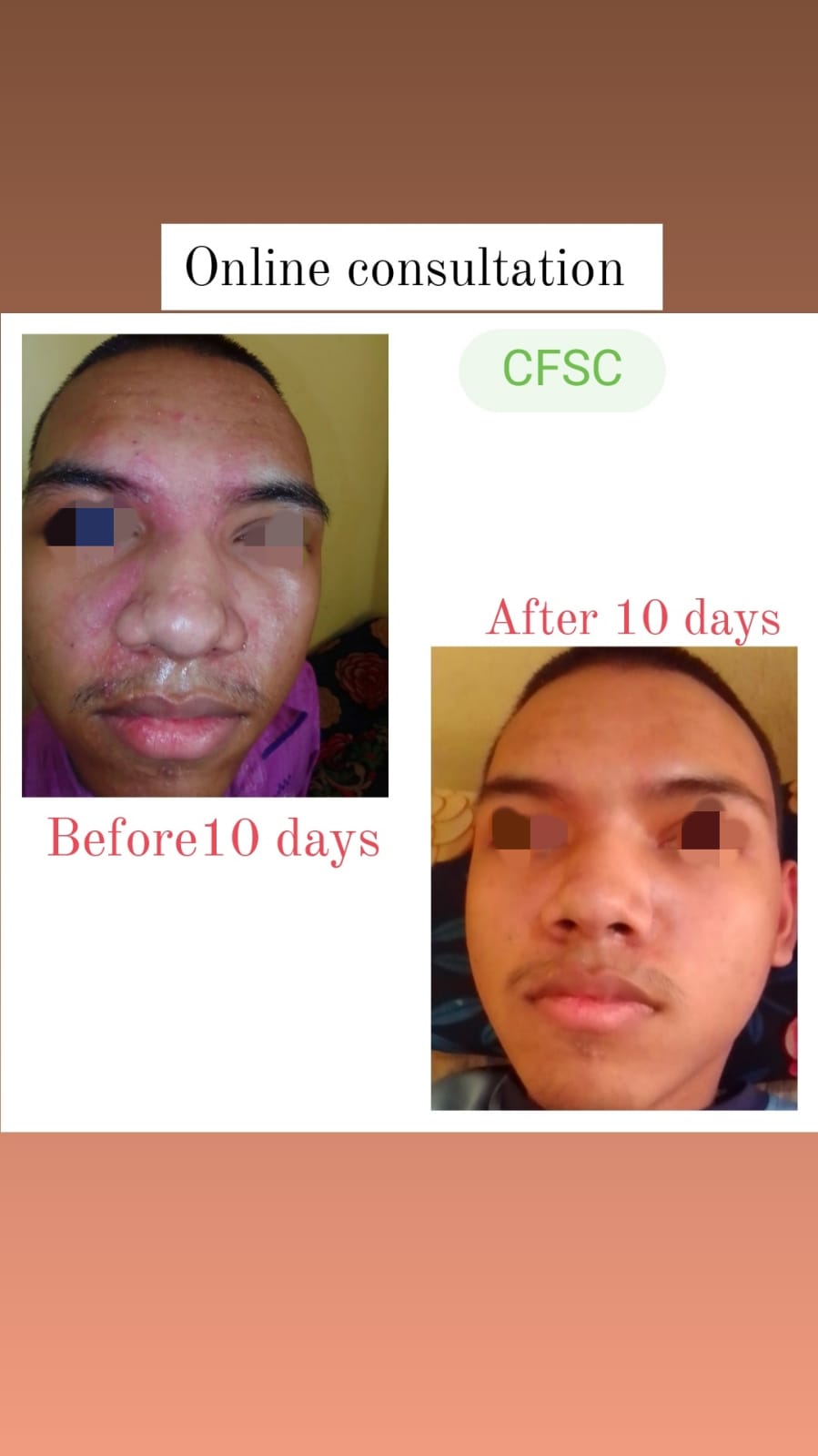 Before After Facial Treatment